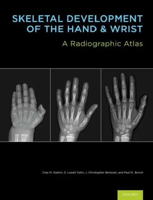 Skeletal Development of the Hand & Wrist: A Radiographic Atlas & Digital Bone Age Companion [With DVD] by Cree M. Gaskin, S. Lowell Kahn, J. Christoper Bertozzi