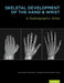 Skeletal Development of the Hand & Wrist: A Radiographic Atlas & Digital Bone Age Companion [With DVD] by Cree M. Gaskin, S. Lowell Kahn, J. Christoper Bertozzi
