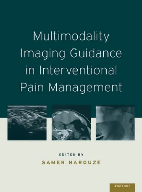 Multimodality Imaging Guidance in Interventional Pain Management by Samer N. Narouze