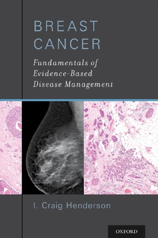 Breast Cancer: Fundamentals of Evidence-Based Disease Management by I. Craig Henderson