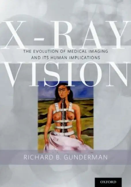 X-Ray Vision: The Evolution of Medical Imaging and Its Human Implications by Richard B. Gunderman