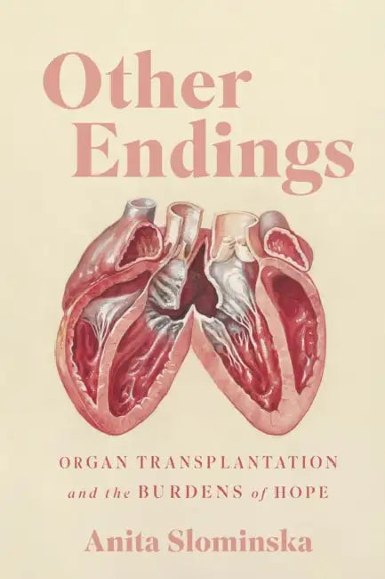 Other Endings: Organ Transplantation and the Burdens of Hope by Anita Slominska