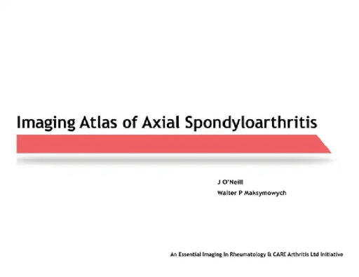 Imaging Atlas of Axial Spondyloarthritis by J. O'Neill