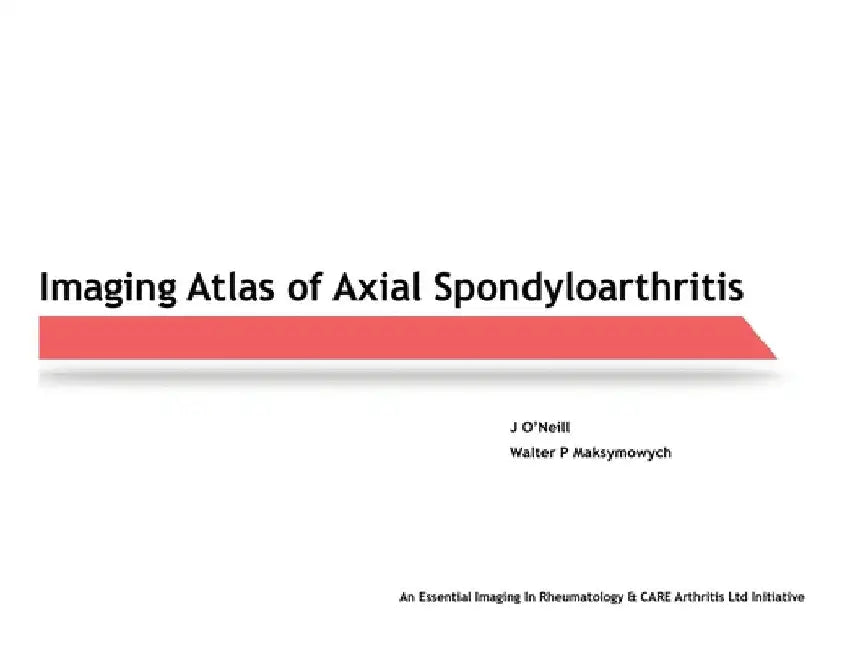 Imaging Atlas of Axial Spondyloarthritis by J. O'Neill