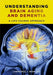 Understanding Brain Aging and Dementia: A Life Course Approach by Lawrence Whalley