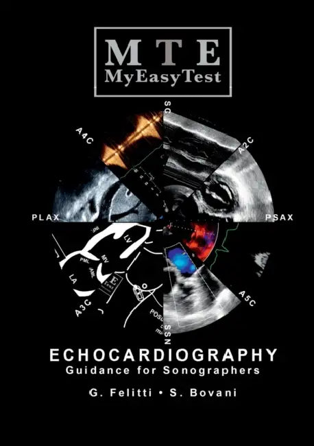 Echocardiography - MyEasyTest by Giuseppe Felitti, Stefano Bovani