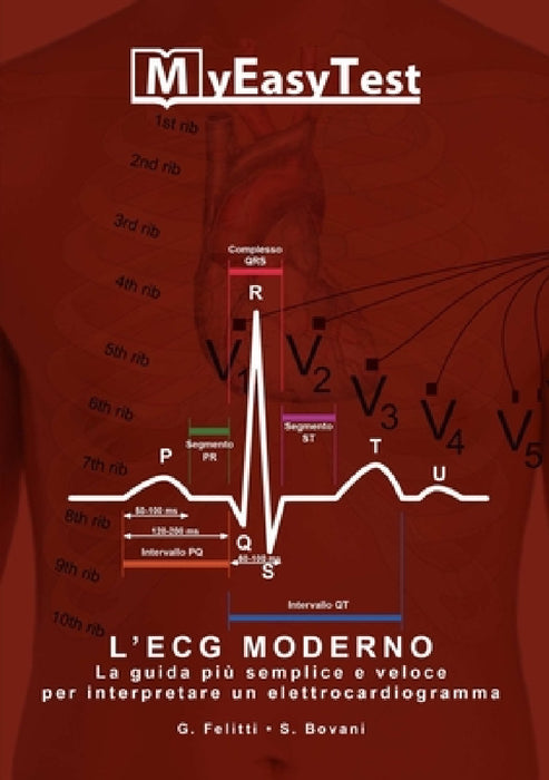 L'ECG Moderno - MyEasyTest (edizione economica) by Giuseppe Felitti, Stefano Bovani