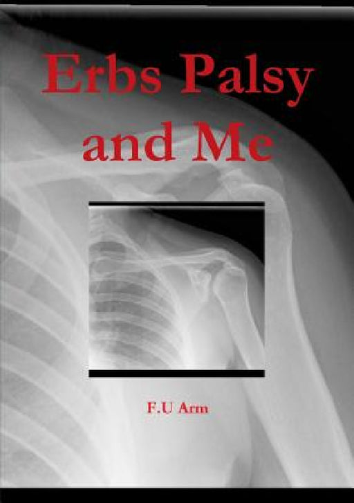Erbs Palsy and Me by F. U. Arm
