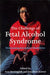 The Challenge of Fetal Alcohol Syndrome: Overcoming Secondary Disabilities by Ann Streissguth, Jonathan Kanter, Mike Lowry