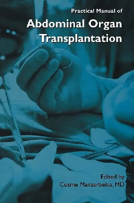 Practical Manual of Abdominal Organ Transplantation by Cosme Manzarbeitia