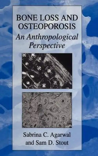 Bone Loss and Osteoporosis: An Anthropological Perspective by Sabrina C. Agarwal