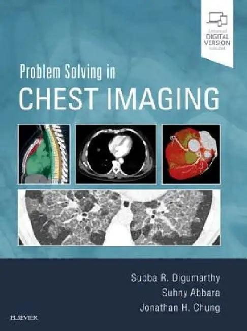 Problem Solving in Chest Imaging by Subba R. Digumarthy