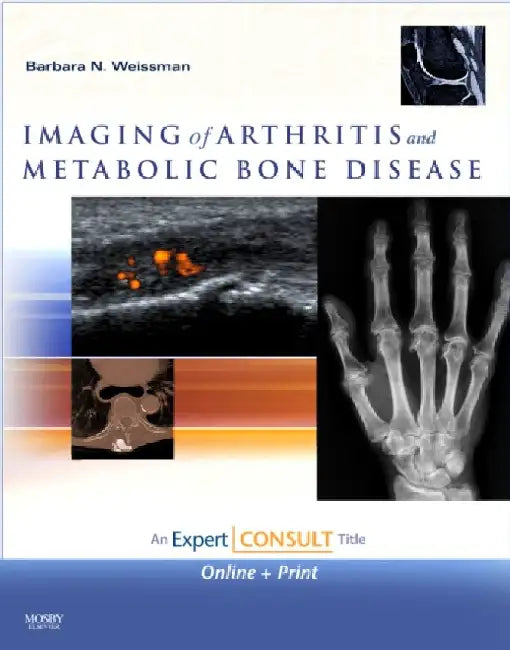 Imaging of Arthritis and Metabolic Bone Disease by Weissman