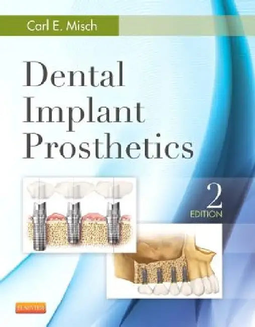 Dental Implant Prosthetics by Carl E. Misch