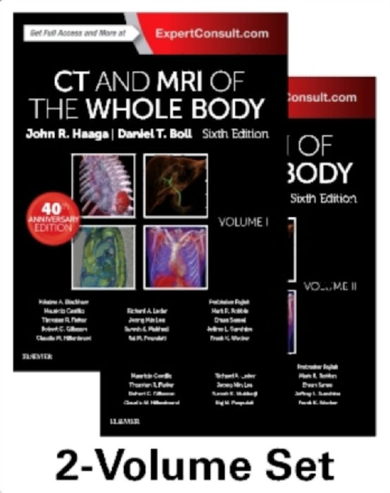 CT and MRI of the Whole Body, 2-Volume Set by John R. Haaga