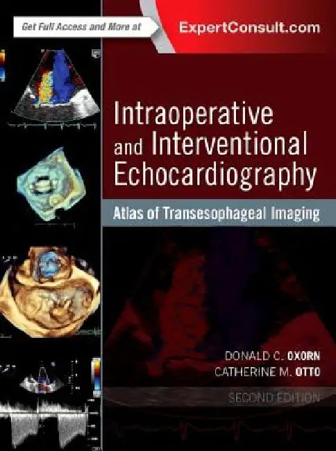 Intraoperative and Interventional Echocardiography: Atlas of Transesophageal Imaging by Donald Oxorn