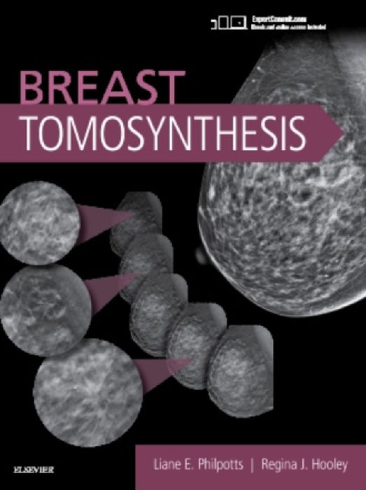 Breast Tomosynthesis by Liane E. Philpotts