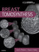 Breast Tomosynthesis by Liane E. Philpotts