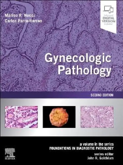 Gynecologic Pathology: A Volume in Foundations in Diagnostic Pathology Series by Marisa R. Nucci