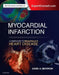 Myocardial Infarction: A Companion to Braunwald's Heart Disease by David A. Morrow