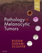 Pathology of Melanocytic Tumors by Klaus J. Busam