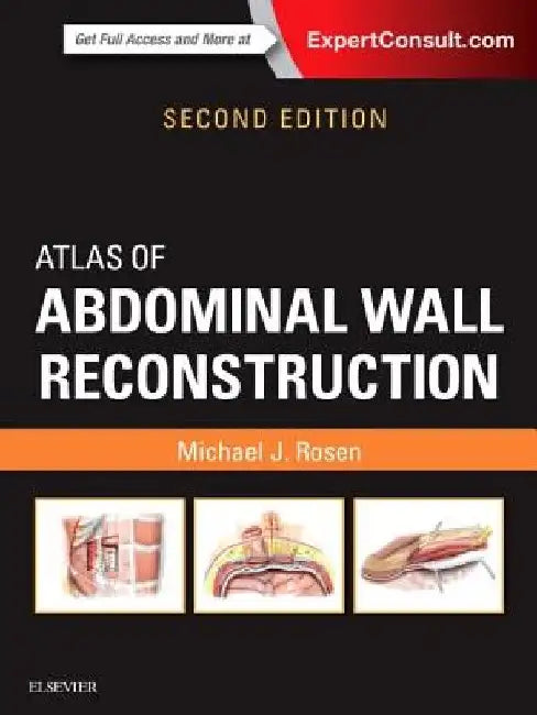 Atlas of Abdominal Wall Reconstruction by Michael J. Rosen