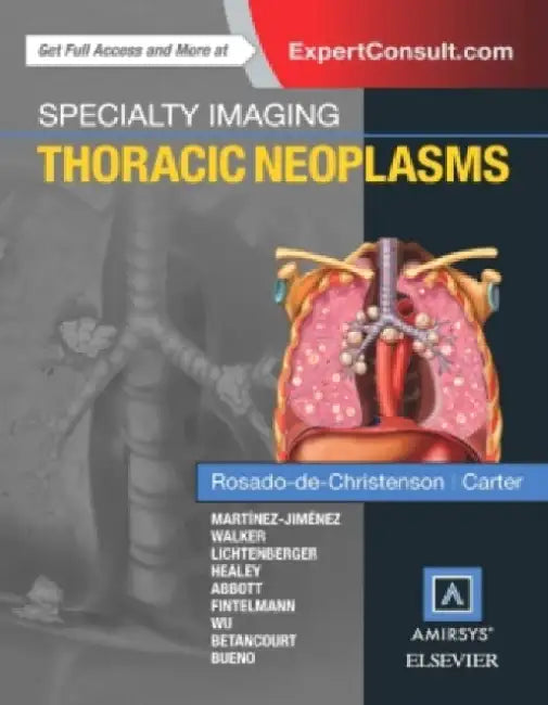 Specialty Imaging: Thoracic Neoplasms by David Groome