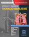 Specialty Imaging: Thoracic Neoplasms by David Groome