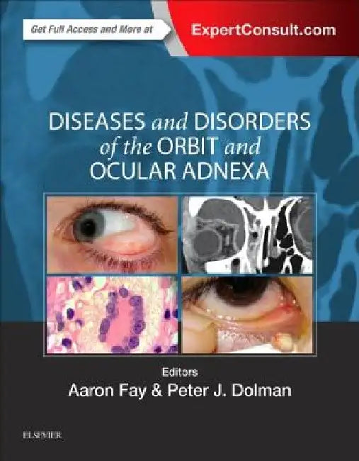 Diseases and Disorders of the Orbit and Ocular Adnexa by Aaron Fay
