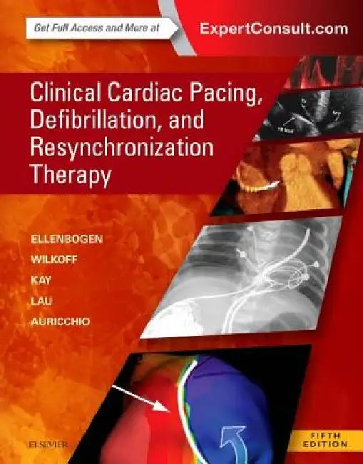 Clinical Cardiac Pacing, Defibrillation and Resynchronization Therapy by Kenneth A. Ellenbogen