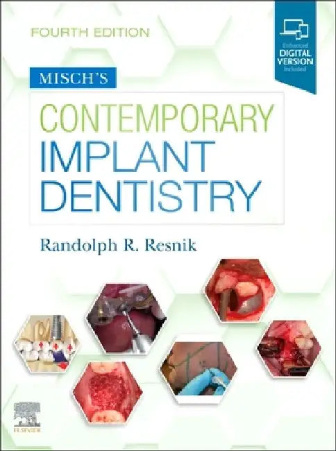 Misch's Contemporary Implant Dentistry by Randolph Resnik