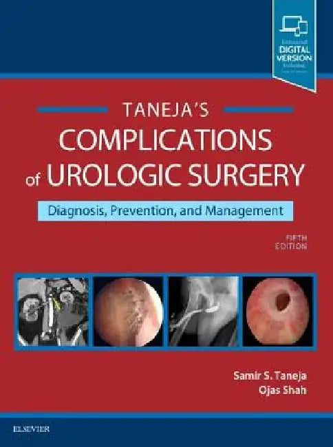Complications of Urologic Surgery: Prevention and Management by Samir S. Taneja