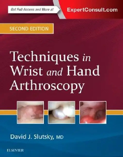Techniques in Wrist and Hand Arthroscopy by David J. Slutsky
