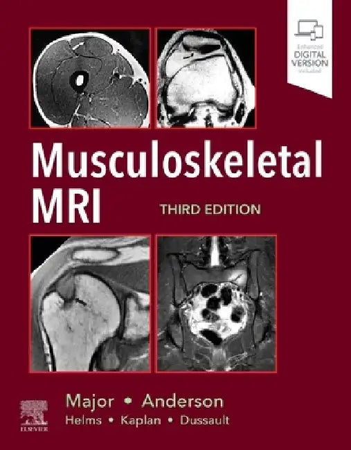 Musculoskeletal MRI by Nancy M. Major