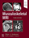 Musculoskeletal MRI by Nancy M. Major
