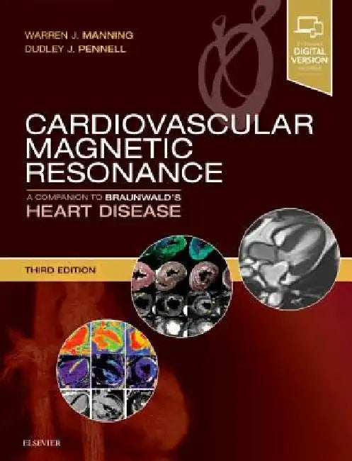 Cardiovascular Magnetic Resonance: A Companion to Braunwald's Heart Disease by Warren J. Manning