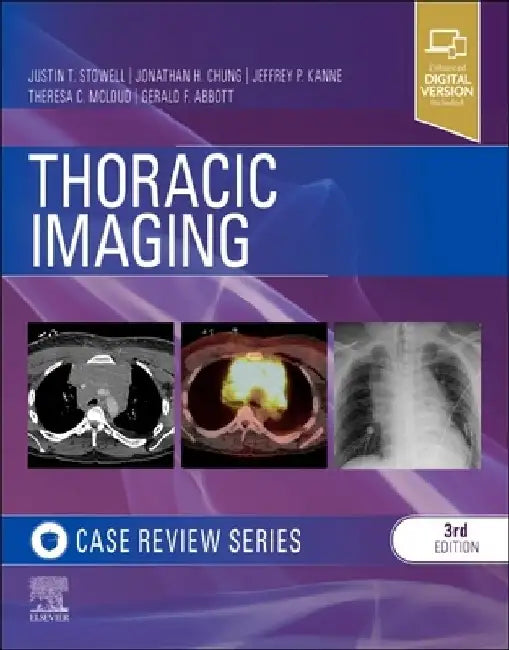 Thoracic Imaging: Case Review by Gerald F. Abbott