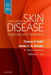 Skin Disease: Diagnosis and Treatment by Thomas P. Habif