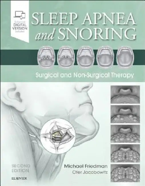 Sleep Apnea and Snoring: Surgical and Non-Surgical Therapy by Michael Friedman