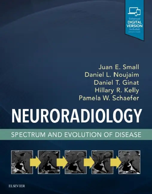 Neuroradiology: Spectrum and Evolution of Disease by Juan E. Small, Daniel L. Noujaim, Daniel T. Ginat