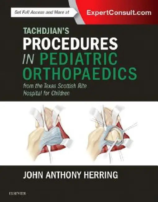 Tachdjian's Procedures in Pediatric Orthopaedics: From the Texas Scottish Rite Hospital for Children by John A. Herring