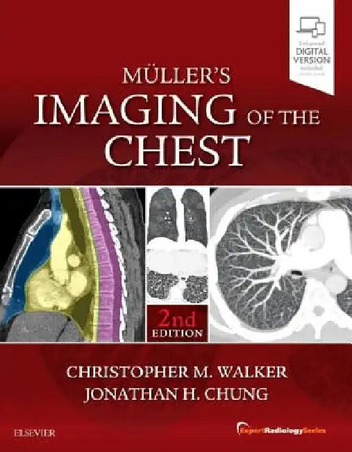 Muller's Imaging of the Chest: Expert Radiology Series by Christopher M. Walker