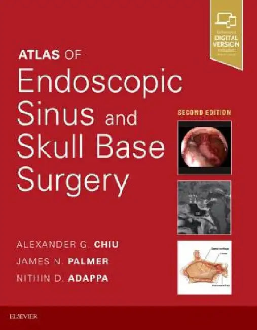 Atlas of Endoscopic Sinus and Skull Base Surgery by Nithin D. Adappa