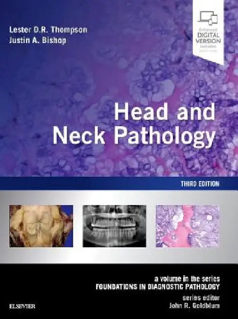 Head and Neck Pathology: A Volume in the Series: Foundations in Diagnostic Pathology by Lester D. R. Thompson