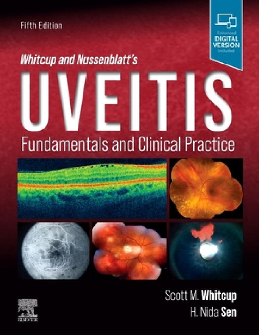 Whitcup and Nussenblatt's Uveitis: Fundamentals and Clinical Practice by Scott M. Whitcup
