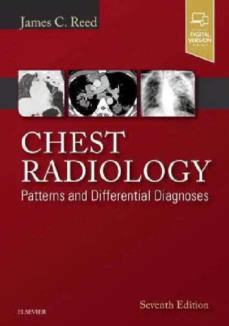 Chest Radiology: Patterns and Differential Diagnoses by James C. Reed