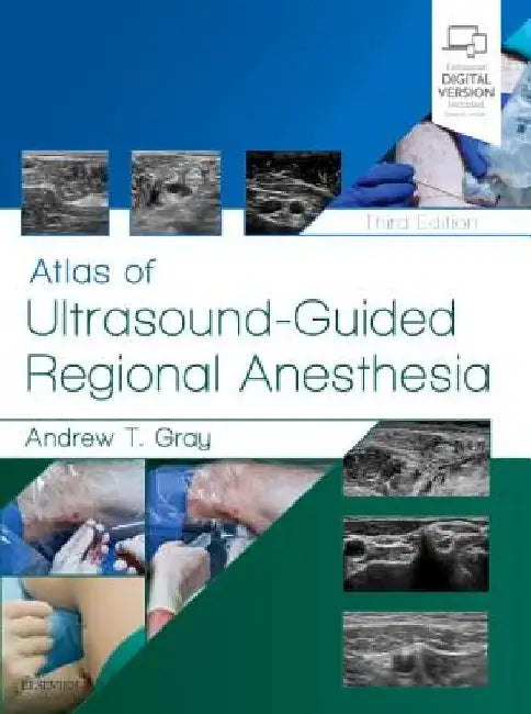Atlas of Ultrasound-Guided Regional Anesthesia by Andrew T. Gray