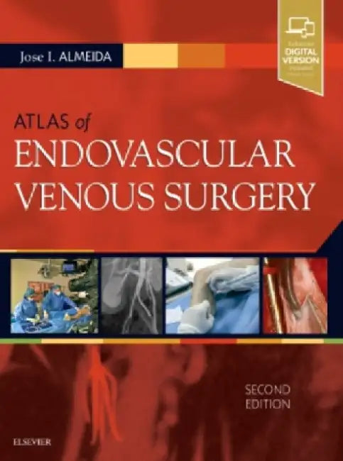 Atlas of Endovascular Venous Surgery by Jose Almeida