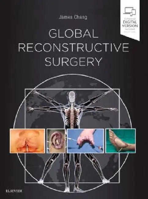 Global Reconstructive Surgery by James Chang