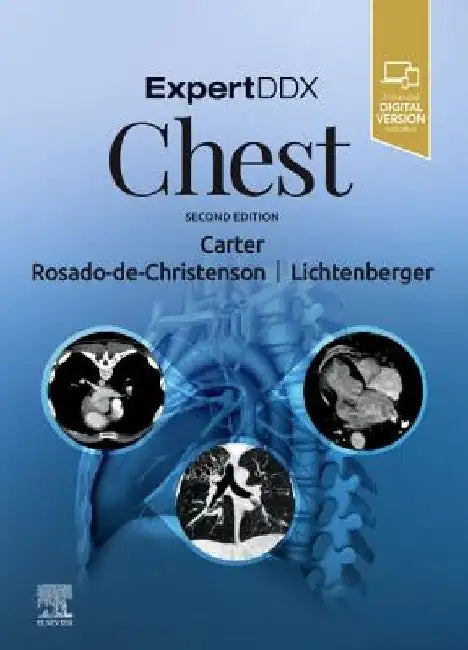 Expertddx: Chest by Brett W. Carter